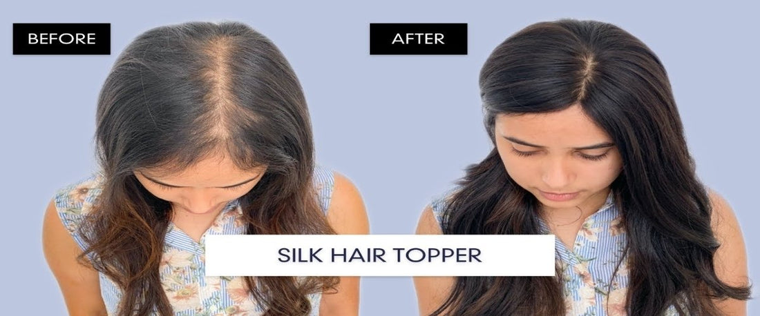 A Guide To Wearing Toppers For Thinning Hair - Tips And Tricks - segohair.com